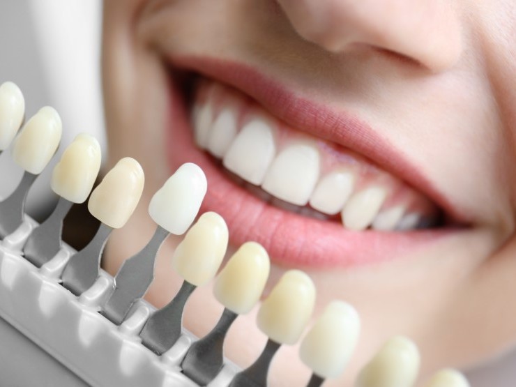 Teeth Whitening: Simple, Safe and Effective